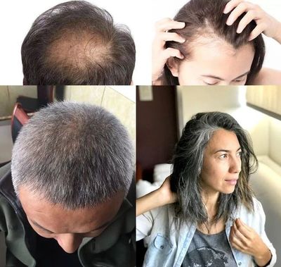 洗頭水中撒一把，頭發(fā)長得又快又茂密，白發(fā)都沒了！